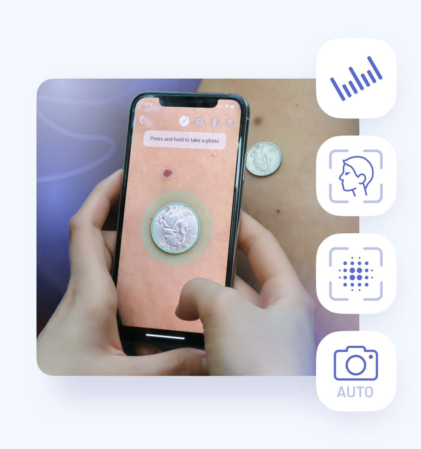 advanced skin imaging