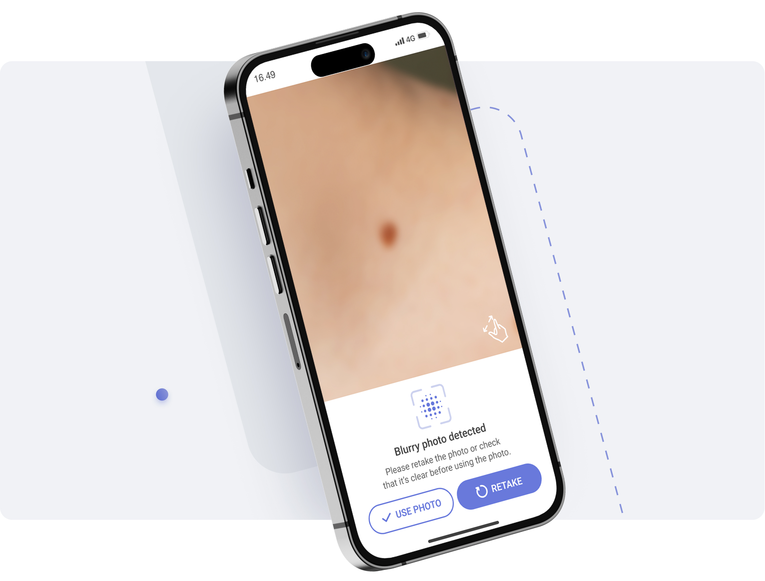 blurriness detection with miiskin