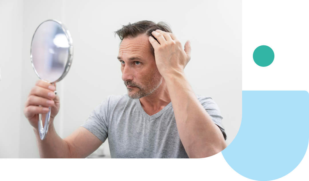 what is oral minoxidil medication
