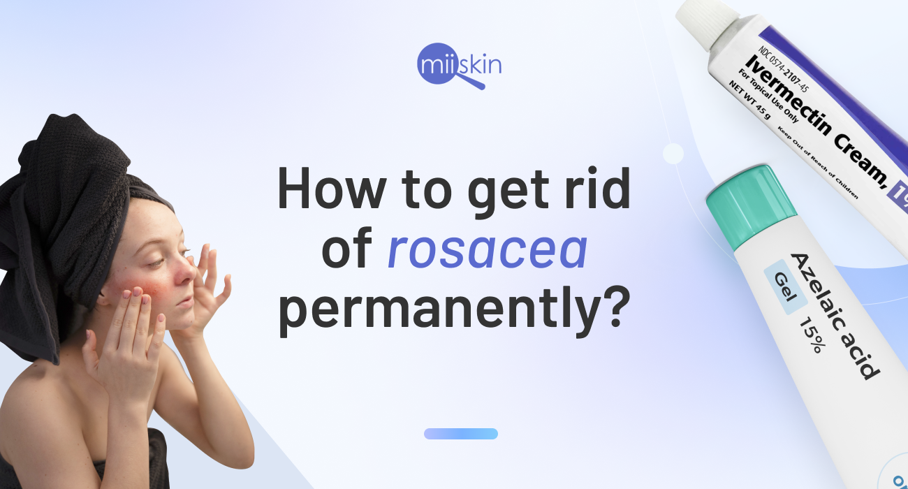 Effective treatments to reduce and manage rosacea symptoms long-term