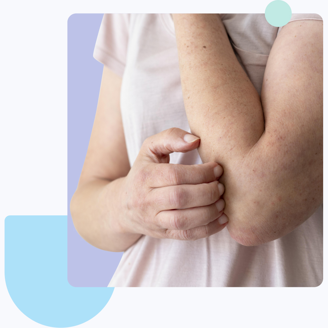 statistic about skin conditions