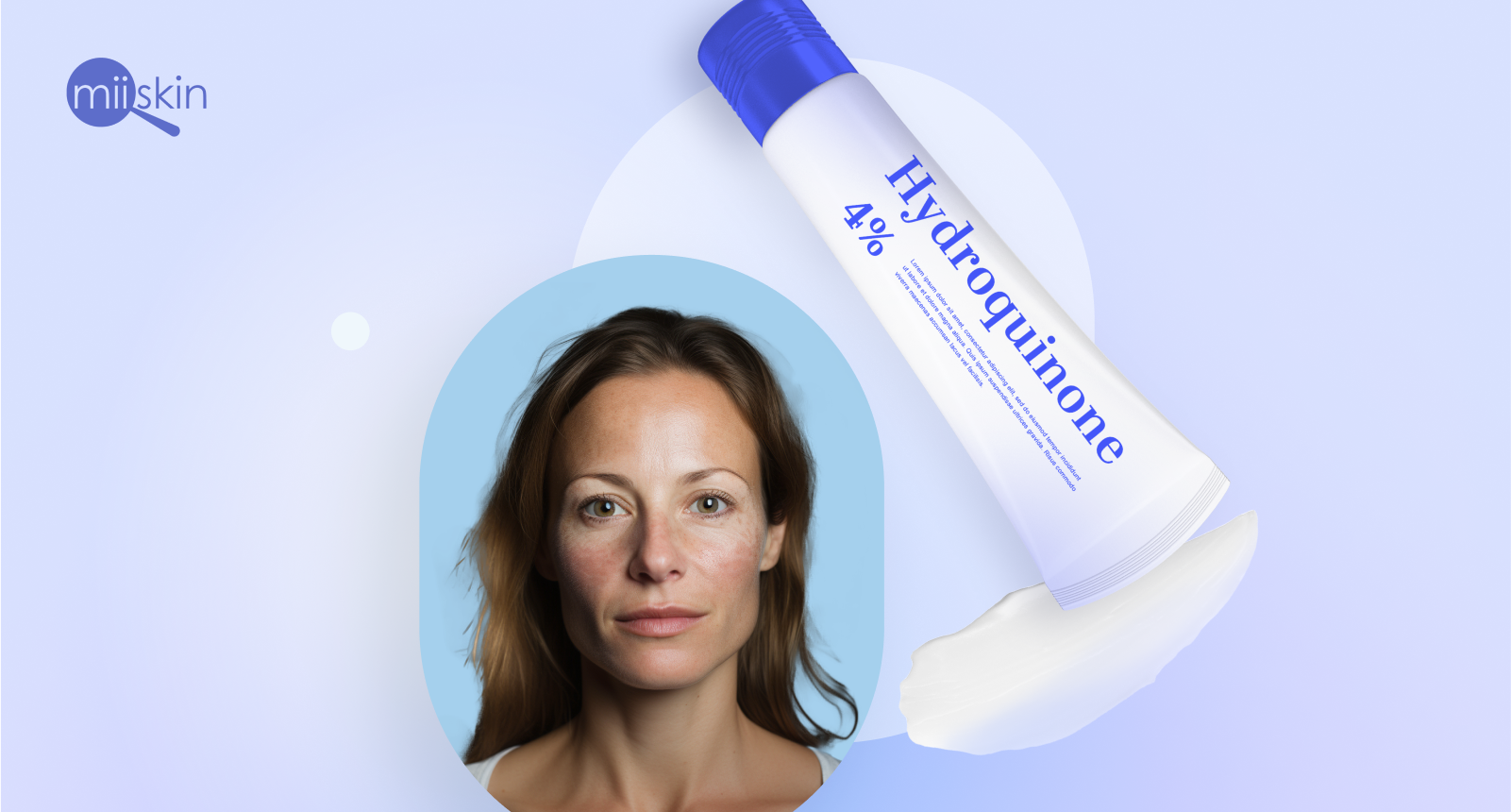 hidroquinona crema de hidroquinona