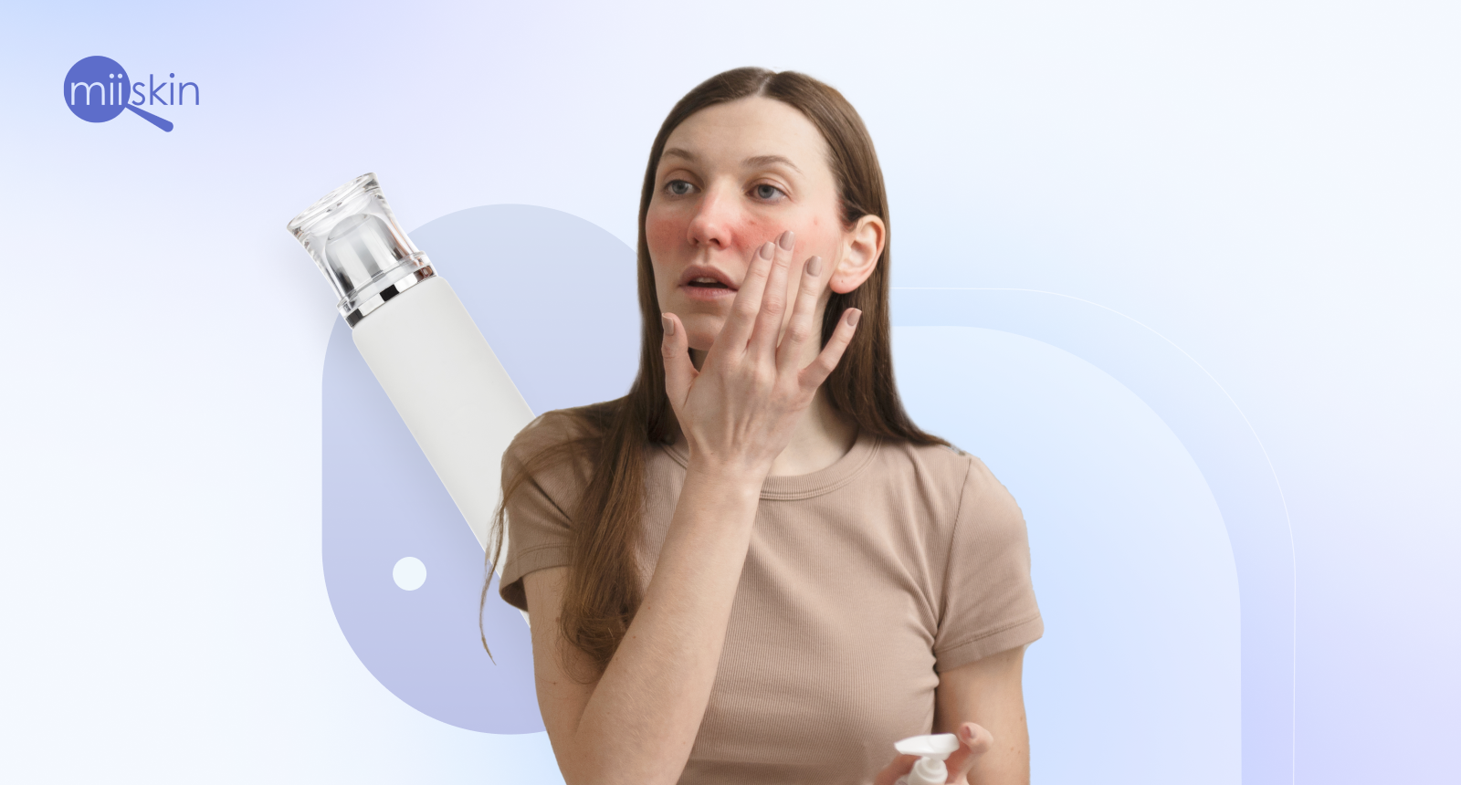 rosacea tratamiento
