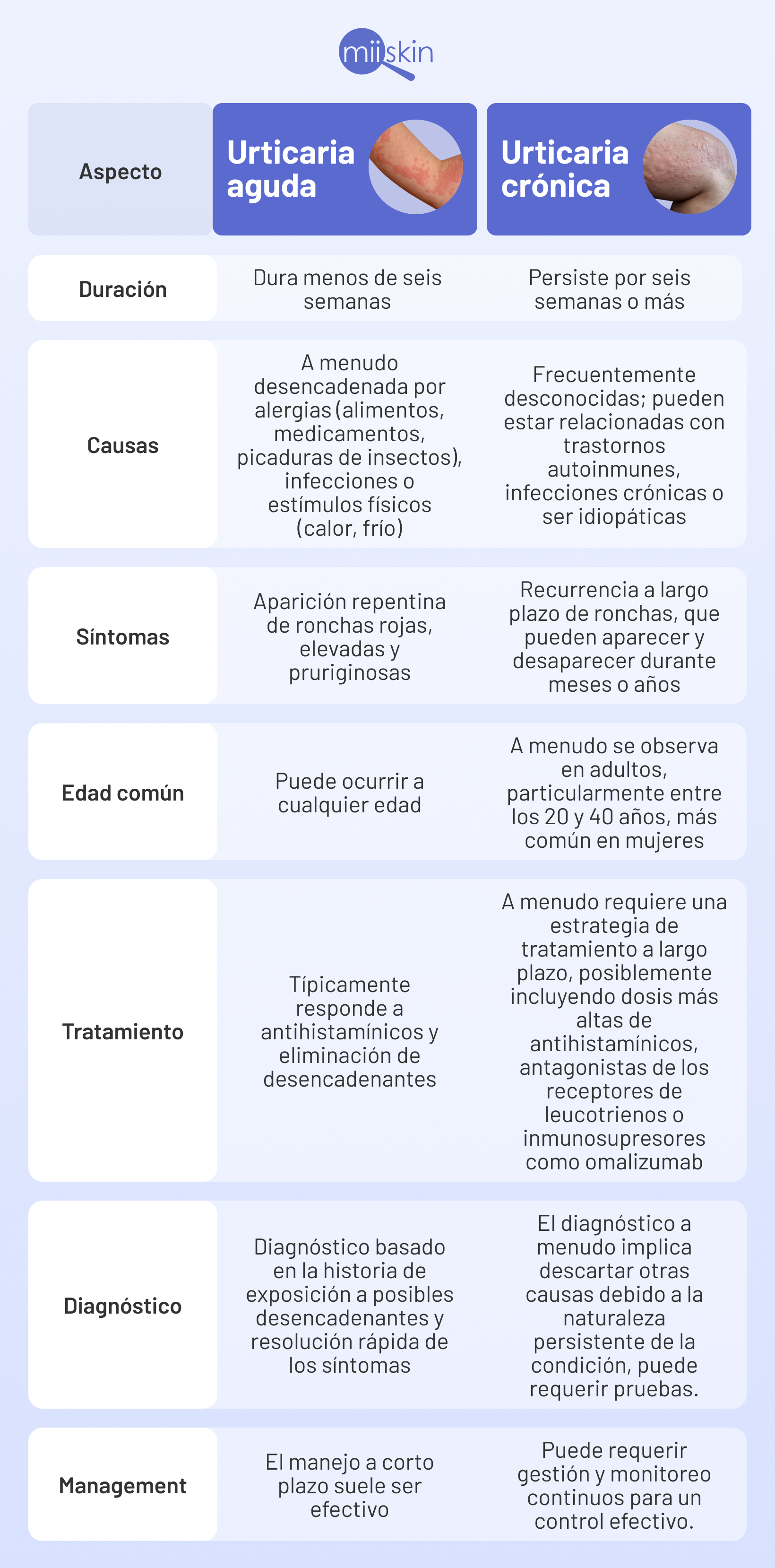 tratamientos para la urticaria aguda y cronica diferencias entre urticaria aguda y cronica