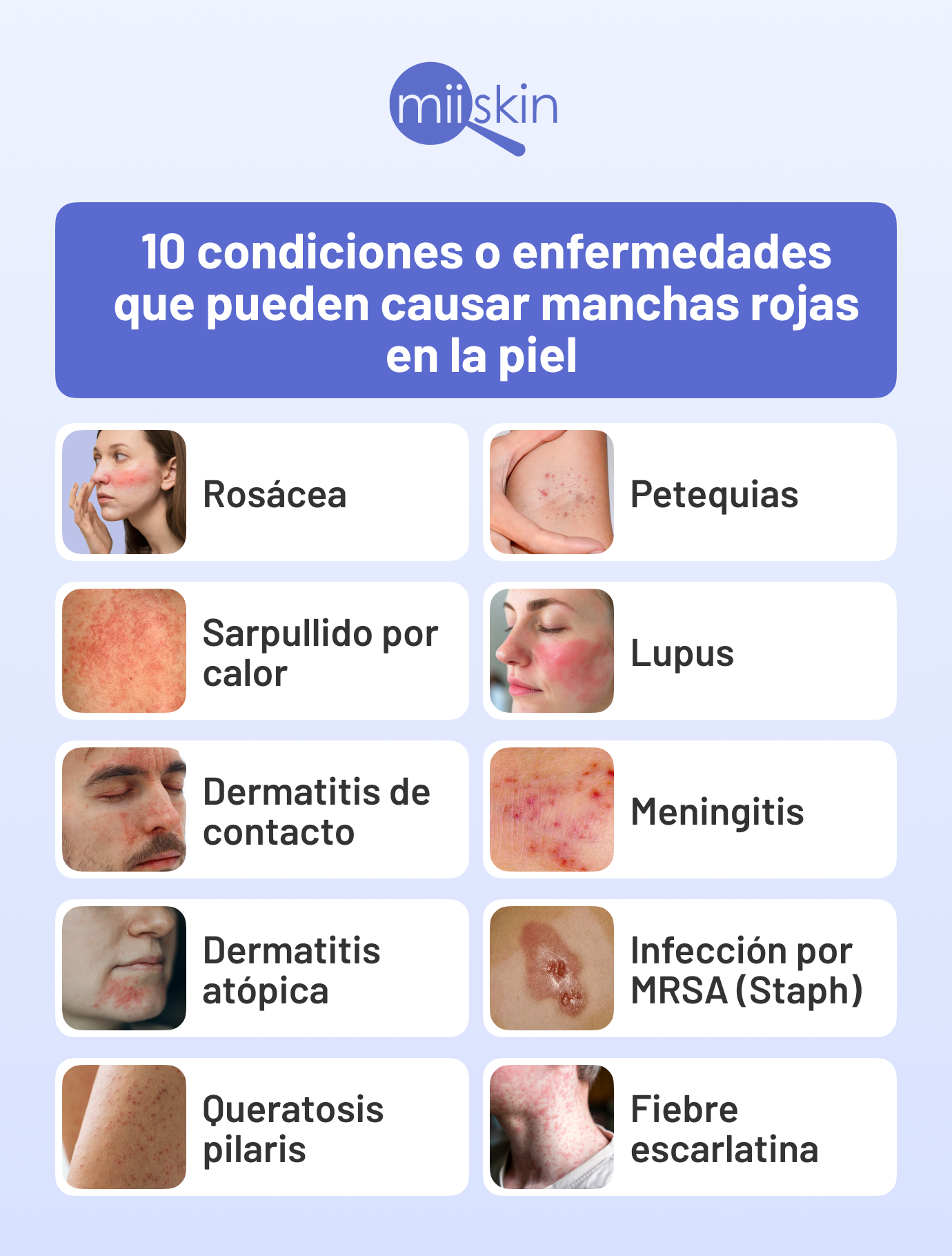 Cuáles son las condiciones que causan manchas rojas en la piel que enfermedades causan manchas rojas en la piel