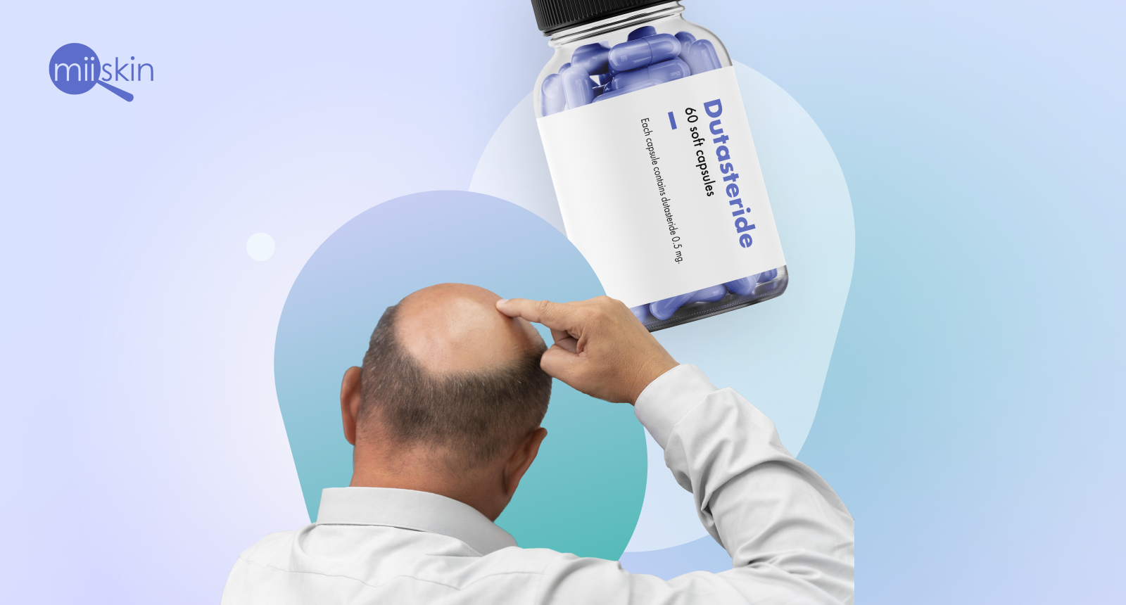 oral dutasteride for hair loss dutasteride pills for androgenetic alopecia