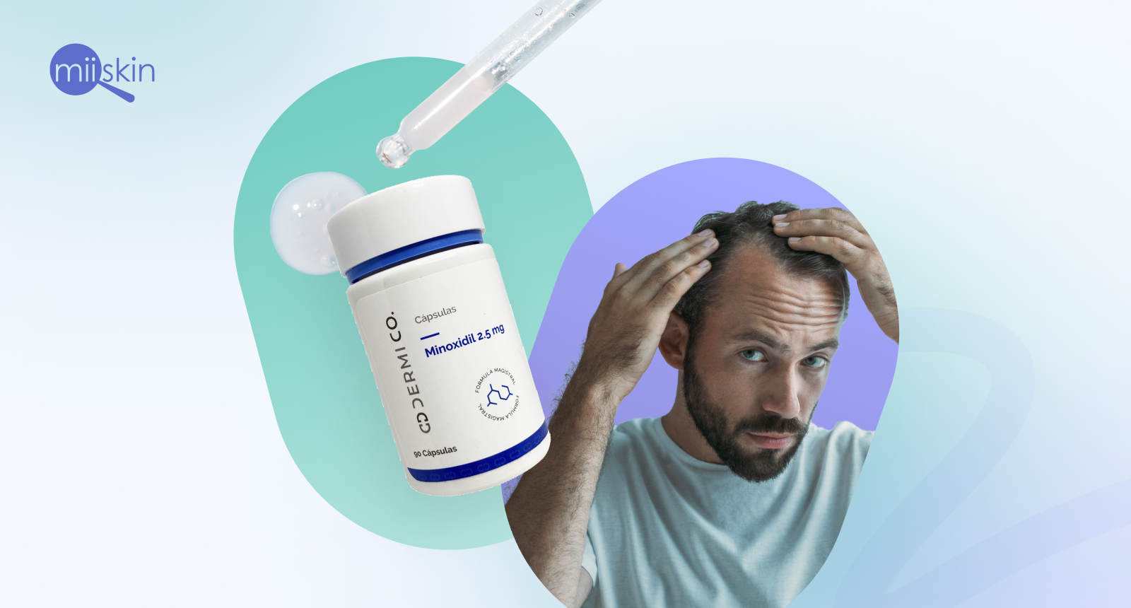 que-es-el-minoxidil-oral