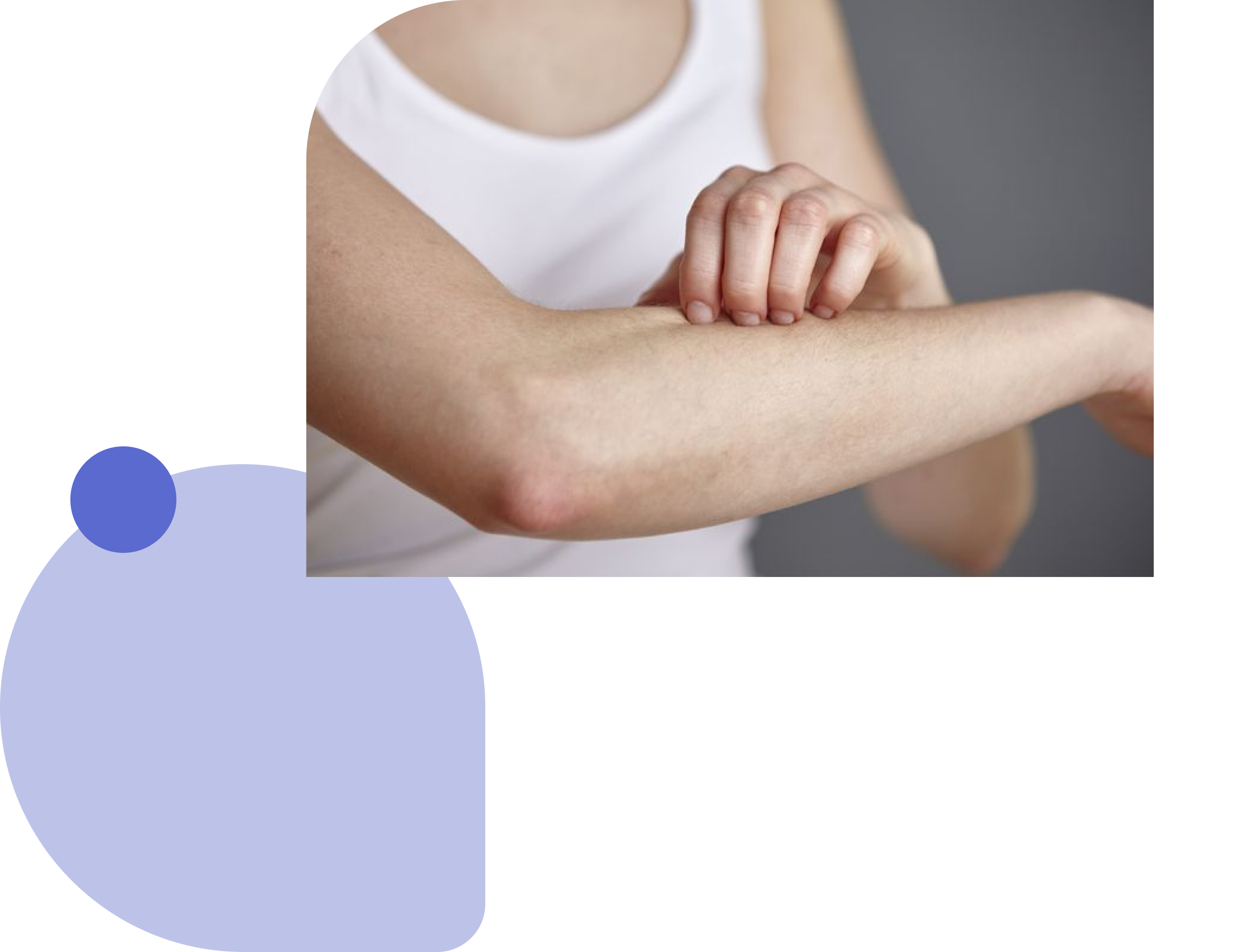 treatment of skin fungal infections