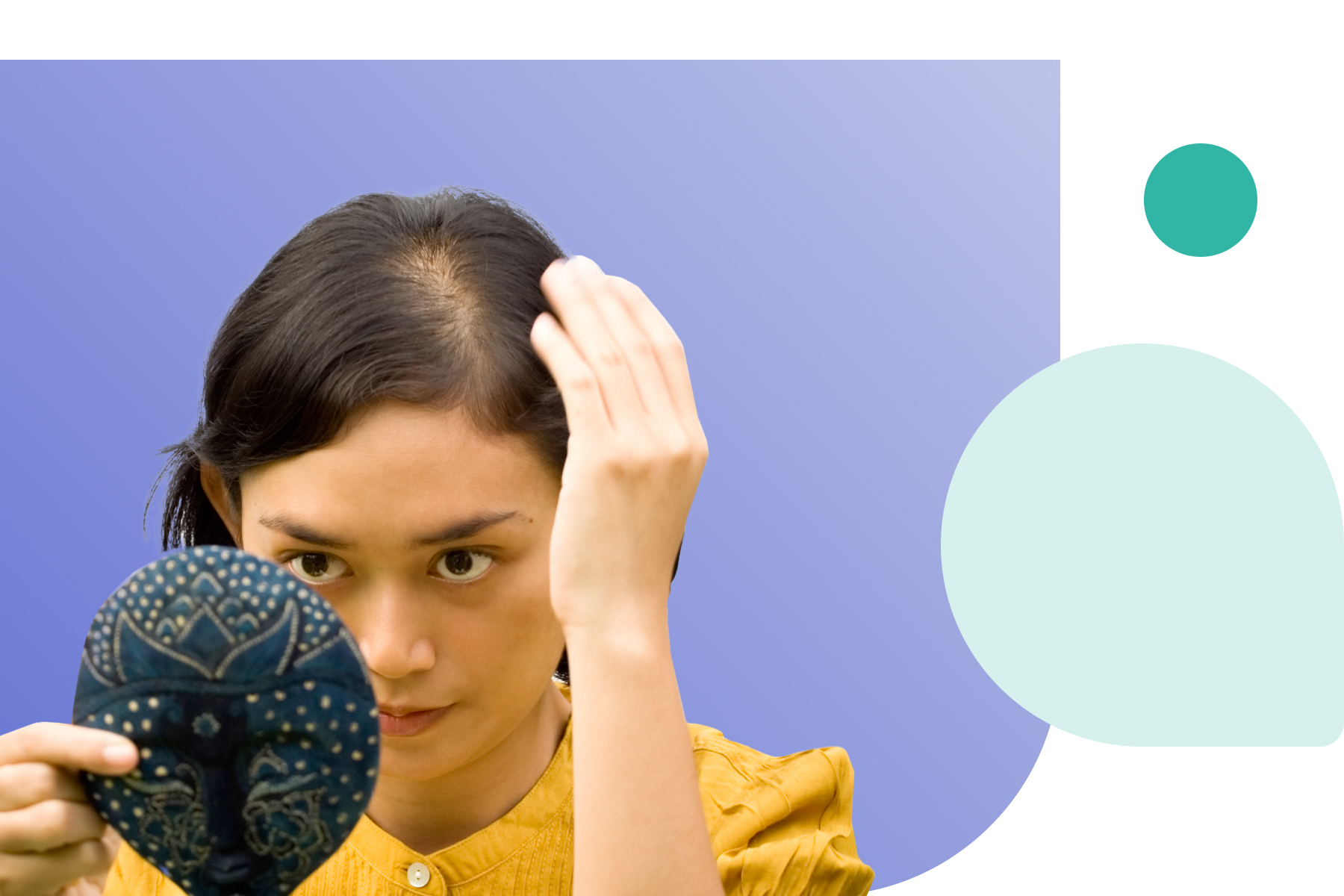 girl with hair loss problem holding mirror