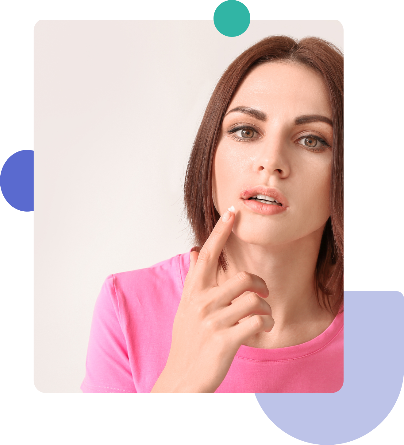 girl with oral herpes
