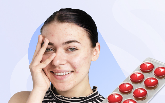 girl hiding her face because of severe acne and accutane tablets beside her