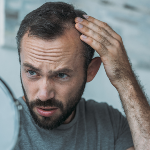 hair loss