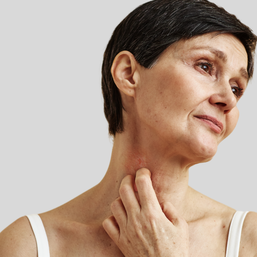 woman with chronic skin condition
