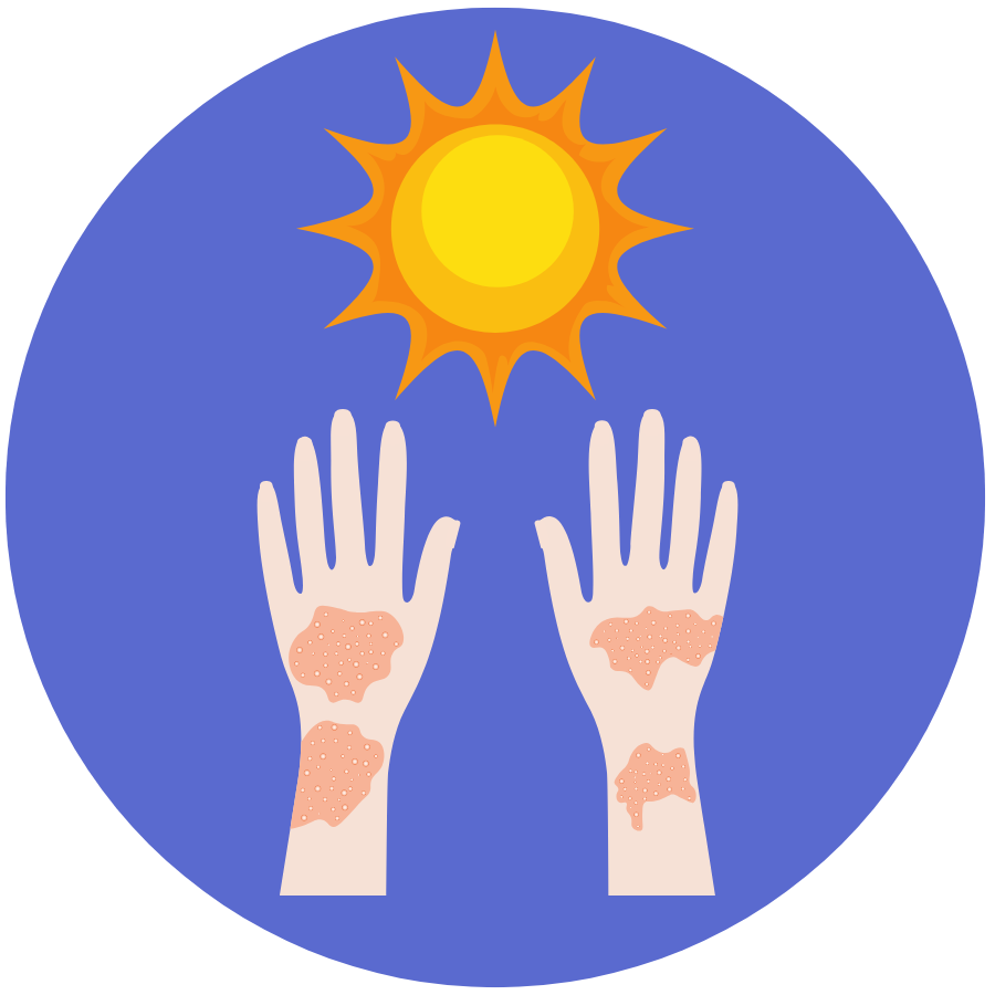 sun sensitivity