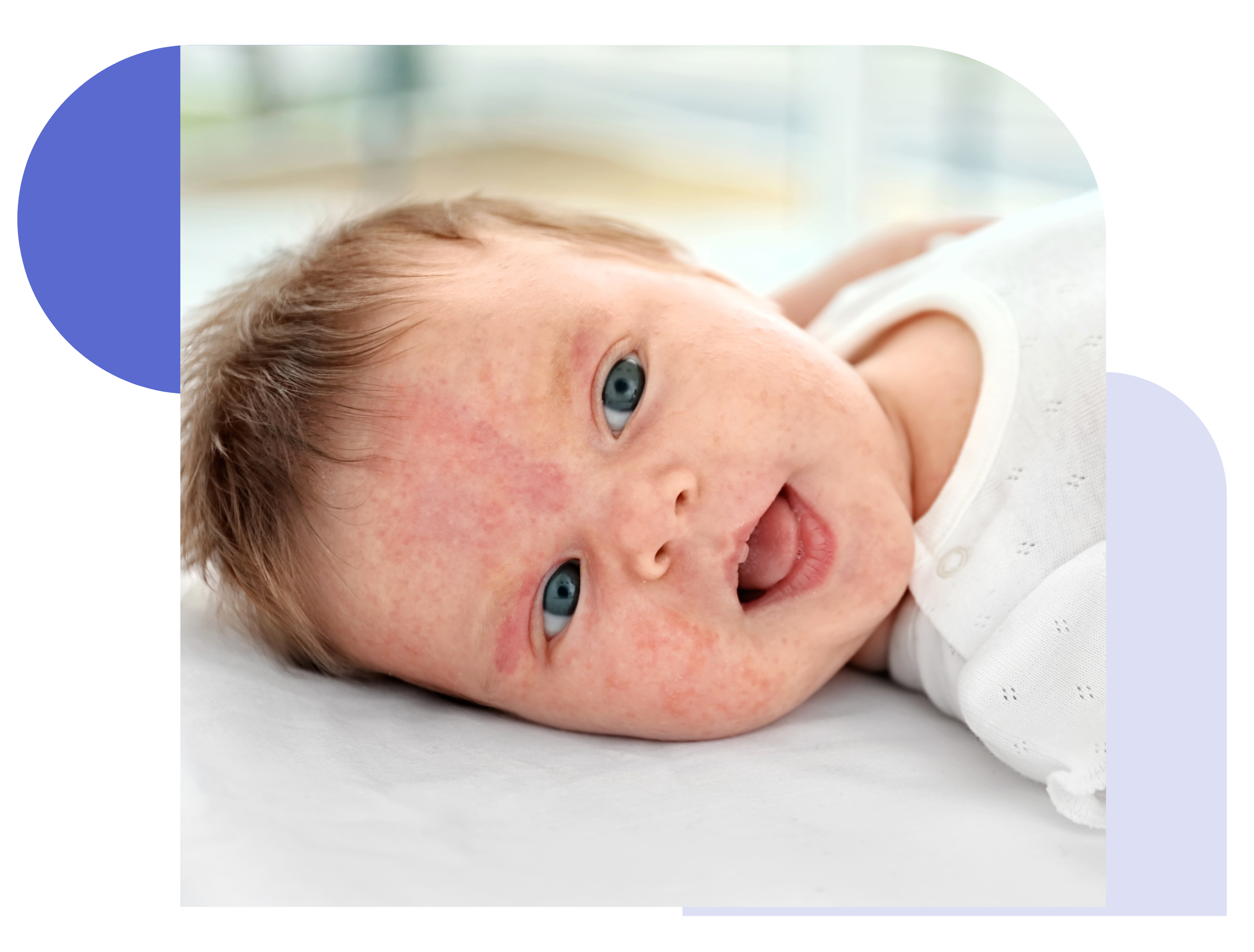 pediatric online dermatologist