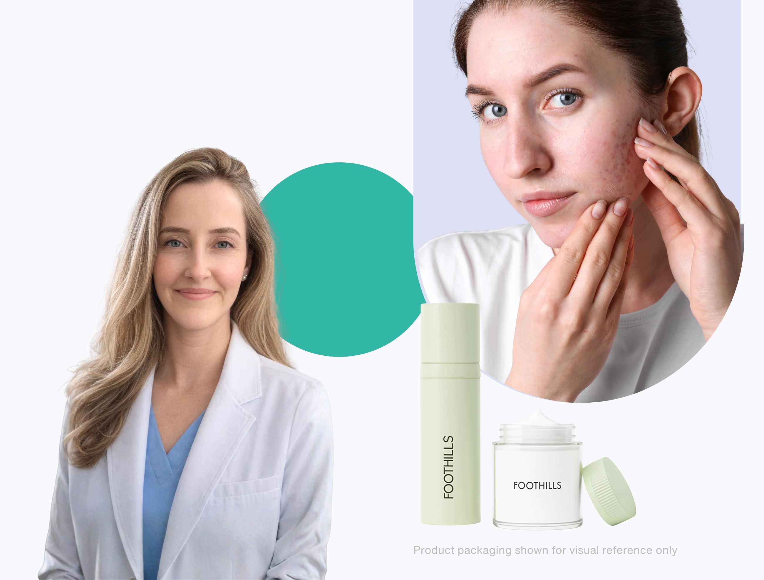 Collage showing a woman with acne on her face and a dermatologist and foothills bottlestazarotene cream 0.1%, and a bottle labeled “FOOTHILLS” on a light background with abstract shapes.