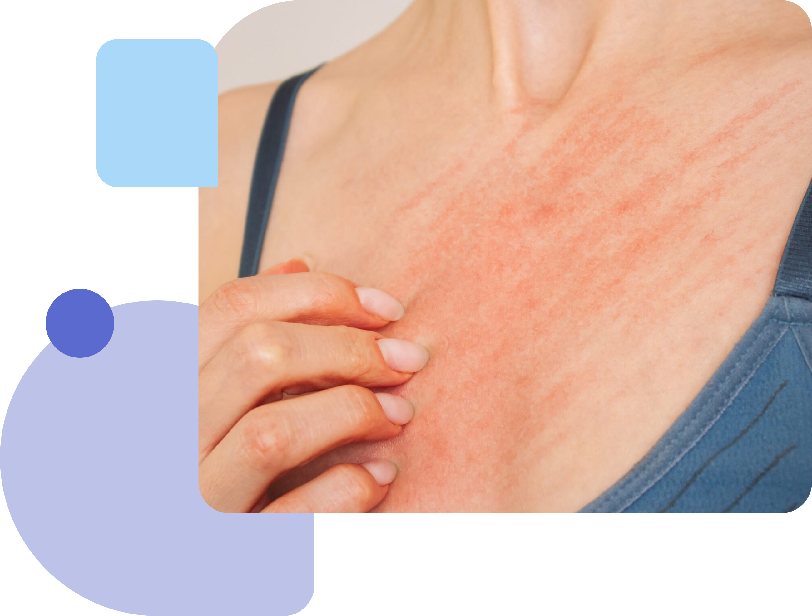 itching skin