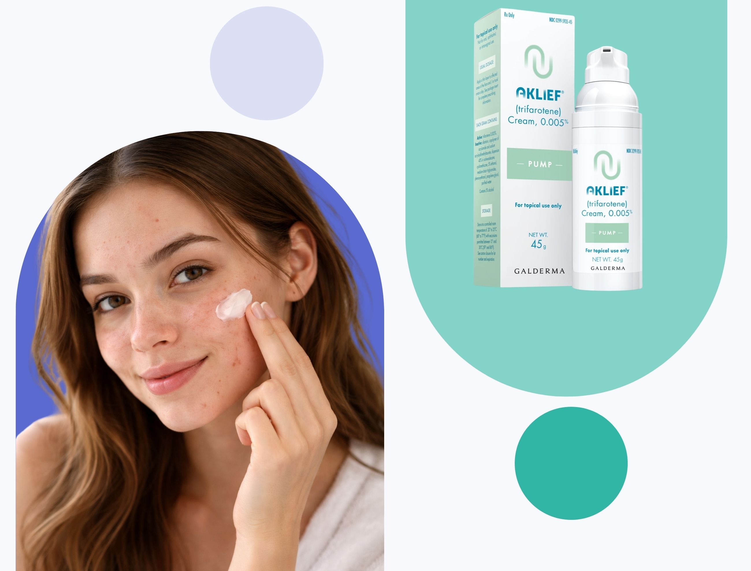 Woman applying acne treatment to her face. On one side, aklief cream