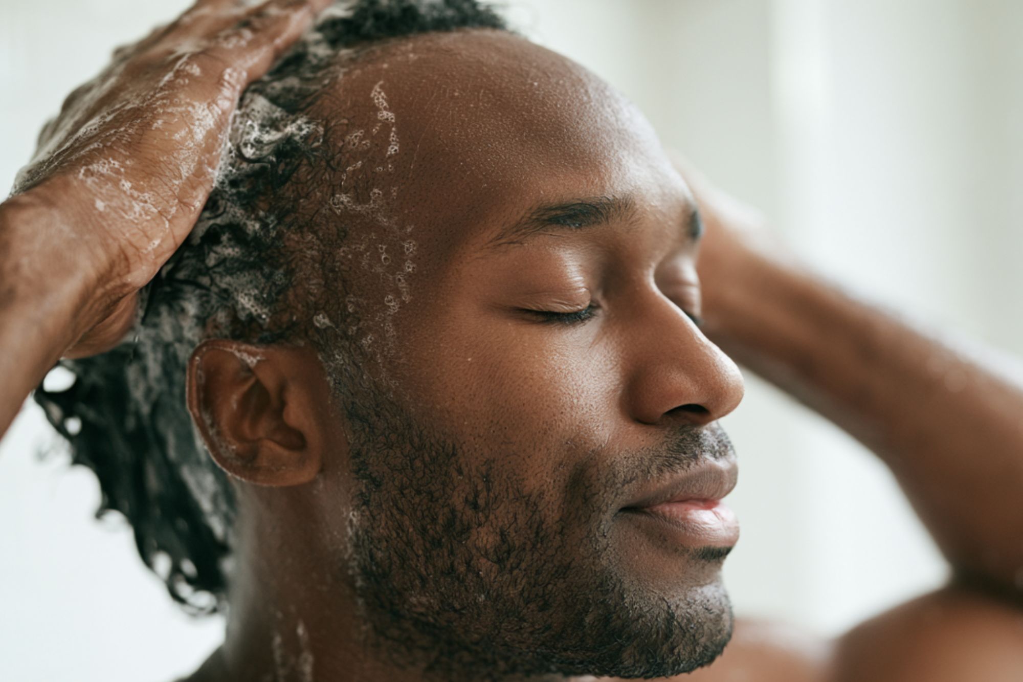 dandruff prescription dandruff shampoo rx