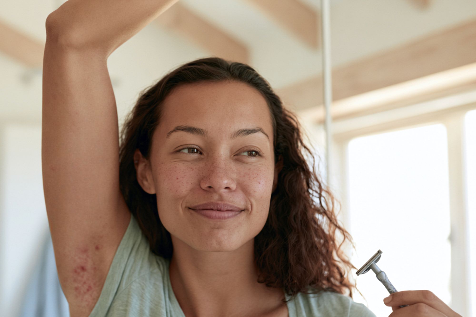 image showing folliculitis on woman's armpit