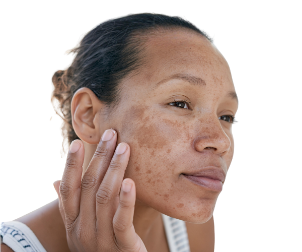 request triluma cream get triluma cream