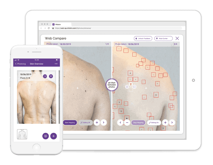 skin mapping map your skin